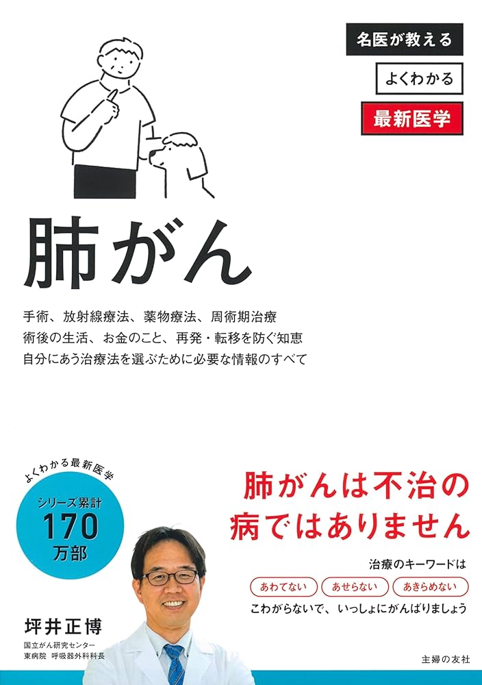 肺がん (よくわかる最新医学シリーズ) | 坪井 正博 |本 | 通販